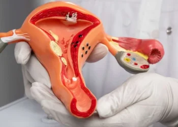 Can Fibroids Be Treated Without Surgery?